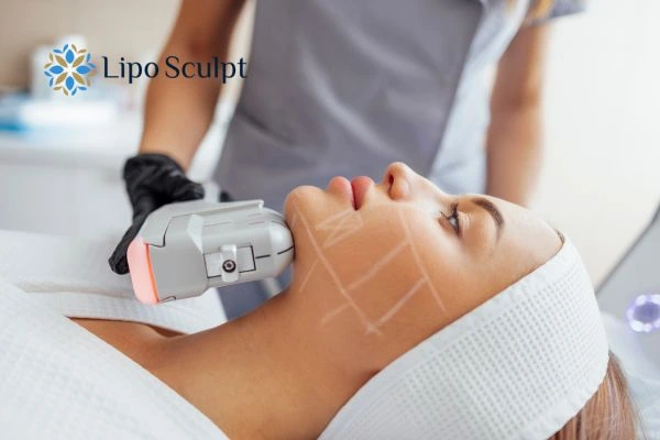 HIFU vs Botulinum Toxin: Understanding the Differences 1 HIFU vs Botox Liverpool What is the best option for you?