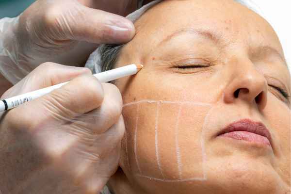 CryoPen: 5 Skin Concerns It May Be Used to Treat 4 What should you ask before having CryoPen treatment Liverpool?
