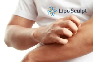 Best Actinic Keratoses Removal 4 prevent your actinic keratoses Liverpool getting worse - call our team today!