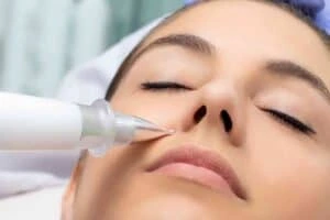 Best Actinic Keratoses Removal 3 Actinic keratoses Liverpool solutions - book in today!