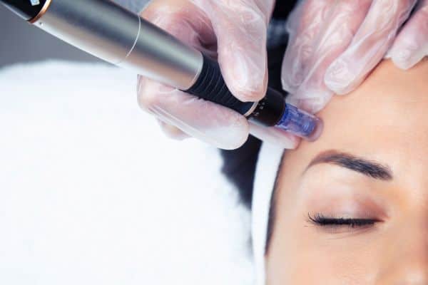 Explaining Total Skin Tightening Treatment and What to Expect 2 What Skin Concerns Can Total Skin Tightening Treatment Help With Liverpool?